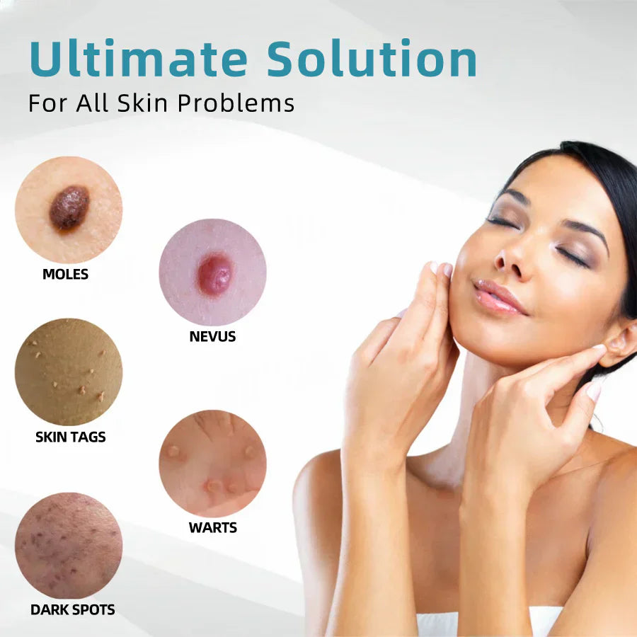 ☂DedMuller® VelvetSkin+Series ⚔️All-in-One Laser Eraser Pen🖊️ (🔬Powered by CO₂ laser technology – effectively removes moles, warts, skin tags, pigmentation spots, and other skin imperfections)