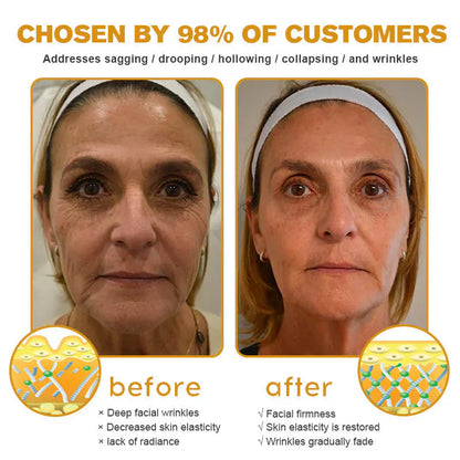 👨‍⚕️ Hergestellt und versendet in den DE ✅ Botox-Bienengift-Faltenentfernungscreme – LETZTER TAG 80 % RABATT