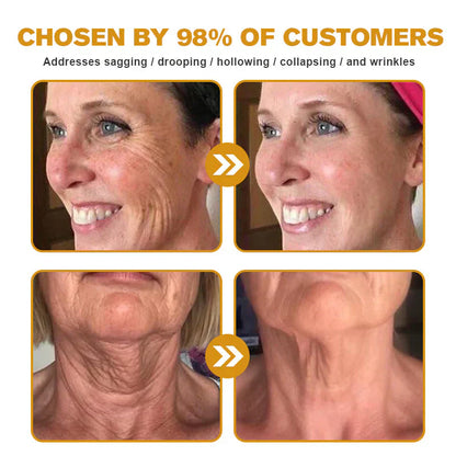 👨‍⚕️ Hergestellt und versendet in den DE ✅ Botox-Bienengift-Faltenentfernungscreme – LETZTER TAG 80 % RABATT